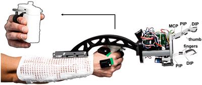 Human-Robotic Variable-Stiffness Grasps of Small-Fruit Containers Are Successful Even Under Severely Impaired Sensory Feedback